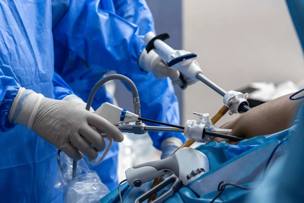 laparoscopic-surgery-gastric-sleeve-bypass-600nw-2506740127